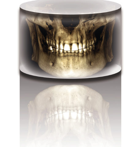 Planmeca Promax Fadente