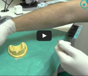 El material en cirugía de implantes-Odontobook