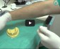 El material en cirugía de implantes-Odontobook