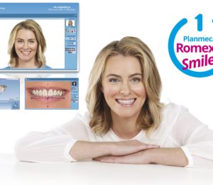 Planmeca Romexis® Smile Design