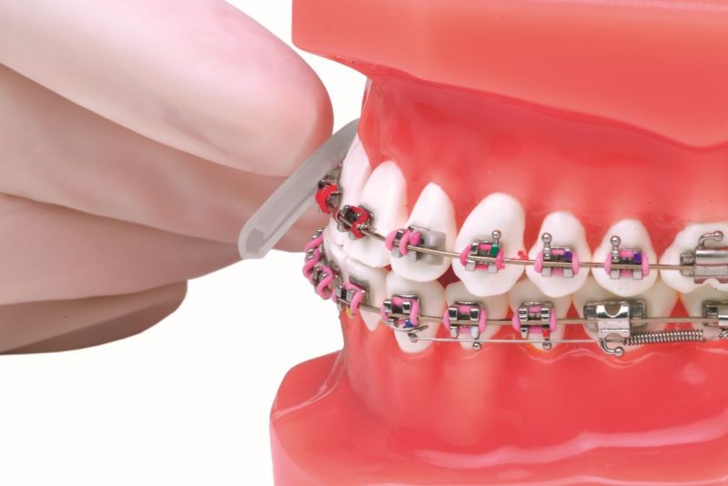 Ruina rehén vitalidad Mi paciente es músico y usa brackets | Blog Proclinic | Toda la información  relevante sobre la odontología