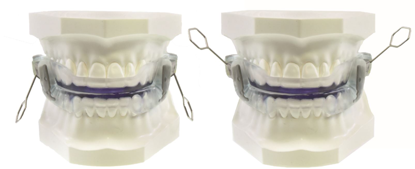 Aparatos orales para la apnea del sueño - Clínica Trei