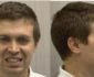 evaluacion facial secret aligner