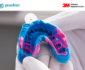 10 claves para una toma de impresion dental perfecta