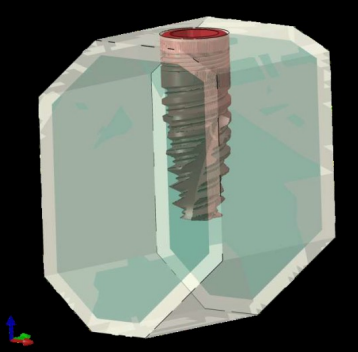 Modelo virtual realizado
a partir de corte de TC